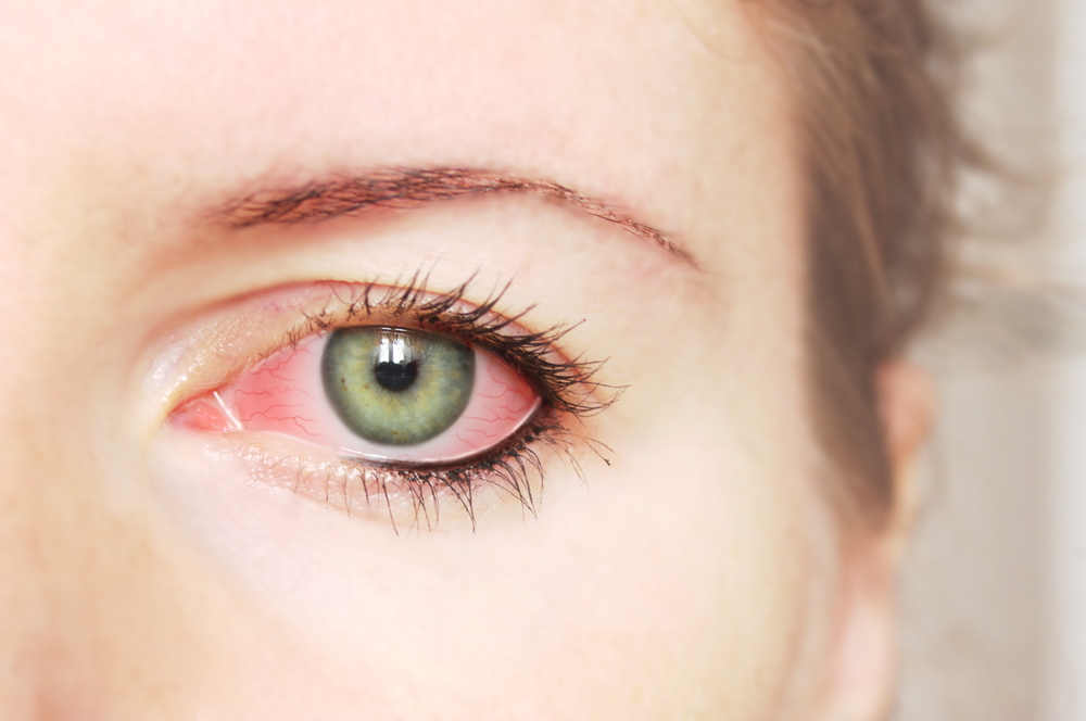 alergie ochi umflati tratament naturist această viziune cu doi ochi