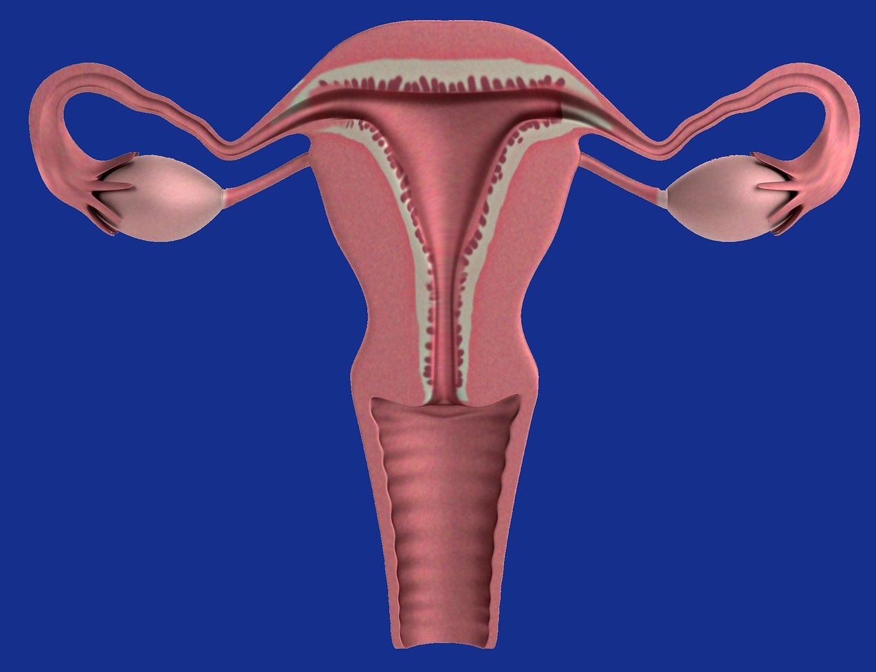 cancerul de endometru simptome