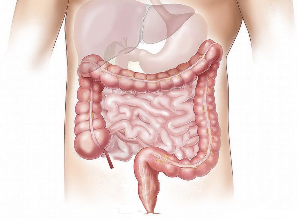 Cancerul De Colon Simptome și Tratament