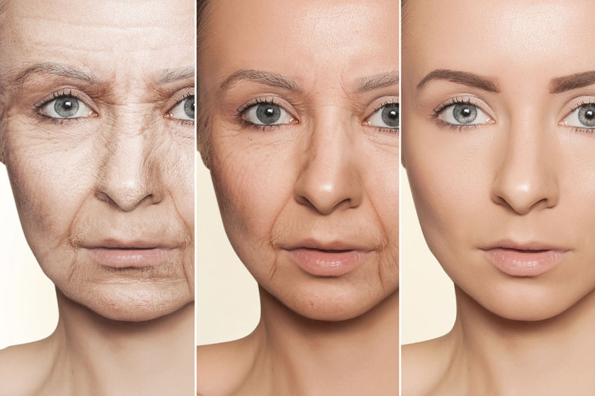 Juvederm Volite – tratament cu acid hialuronic - SKINMED® Clinic