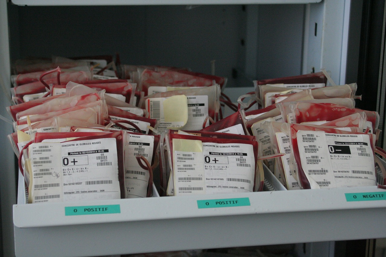 anemia celulară de seceră și pierderea în greutate