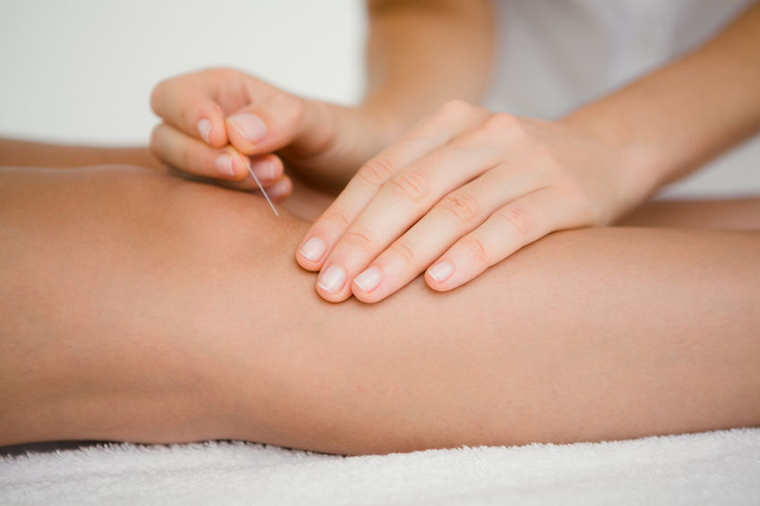 tratamentul acupuncturii artrozei