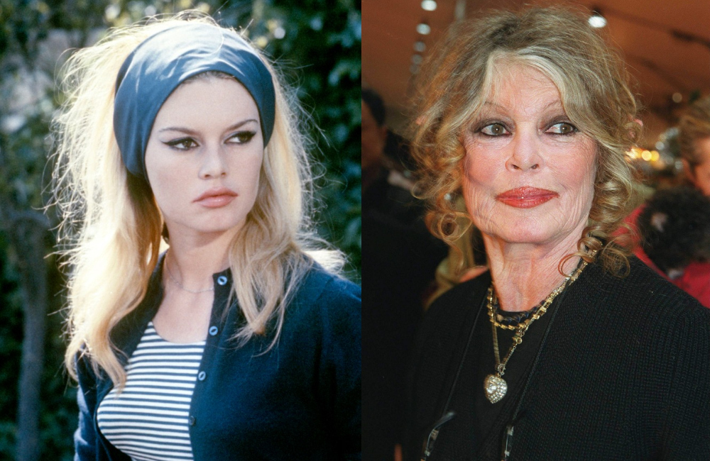 Între viață și moarte". S-a aflat motivul pentru care Brigitte Bardot refuză să se opereze. De ce "a fugit" din spital | Libertatea pentru femei.